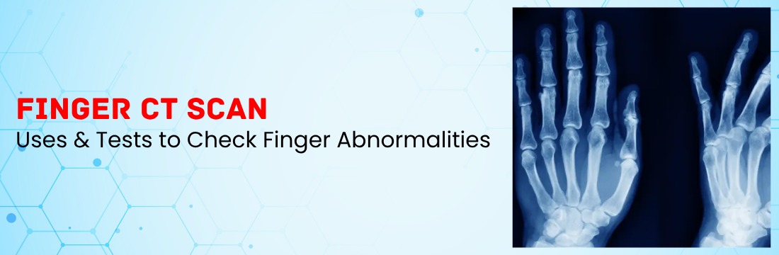 Know Finger CT Scan and its Uses